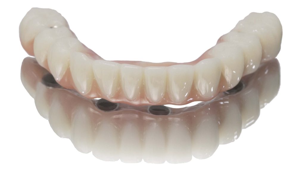 Photo of a 4 on 1 denture - Cancun.