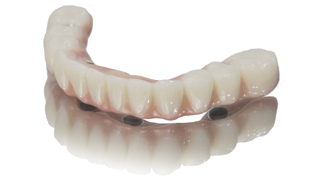 Photo of a 4 on 1 denture - Cancun.