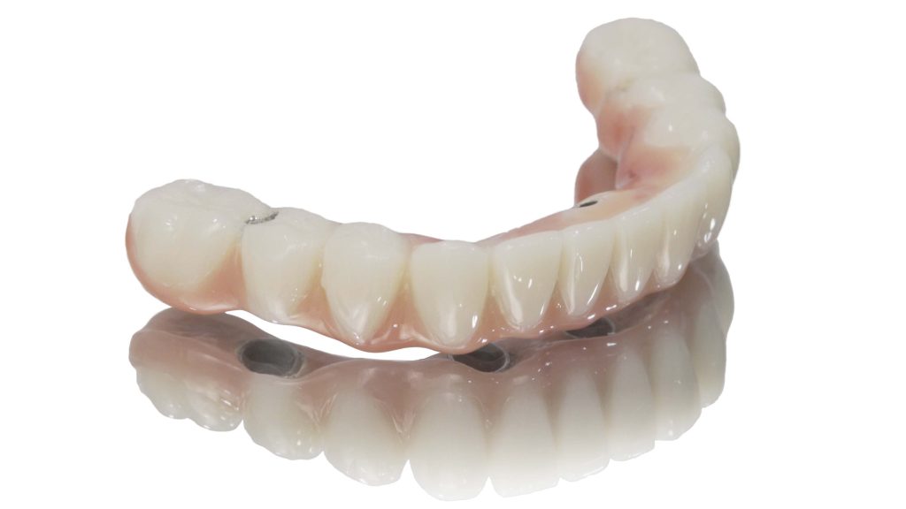 Photo of a 4 on 1 denture - Cancun.